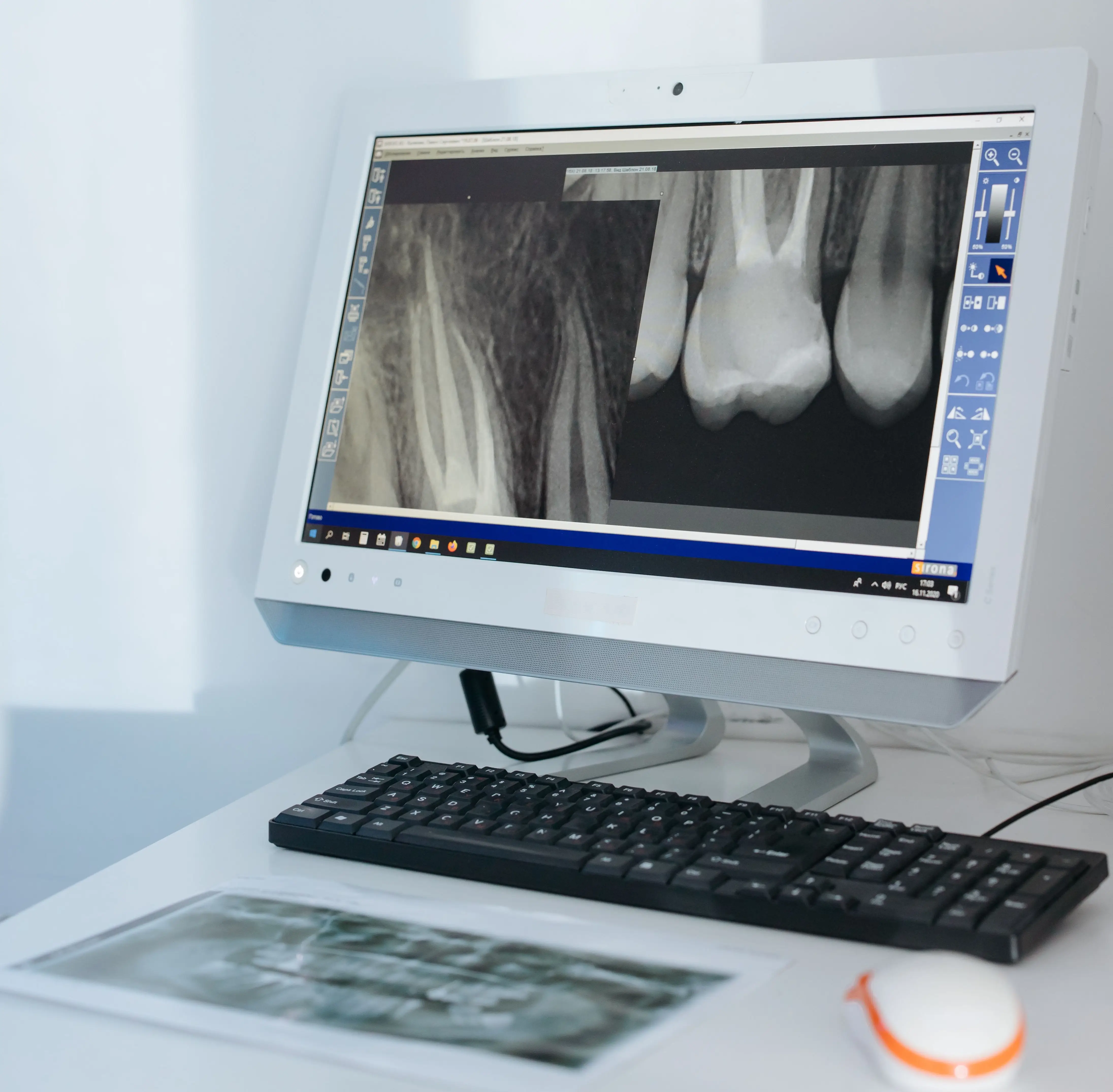 Precision Dental Tools